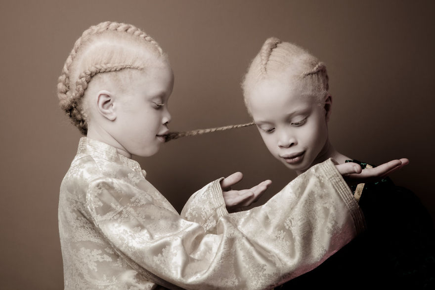 albino-twins-models-