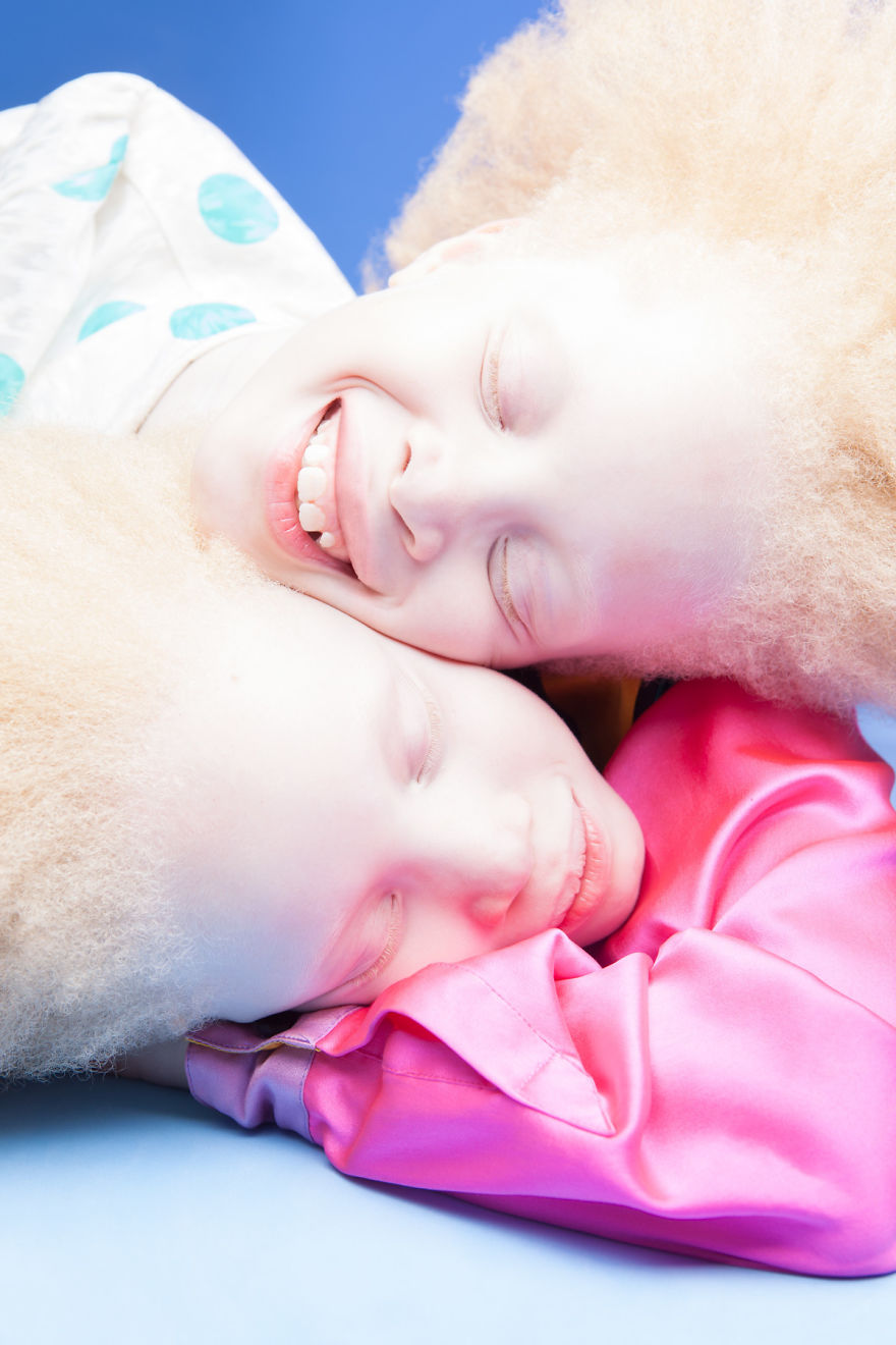albino-twins-models