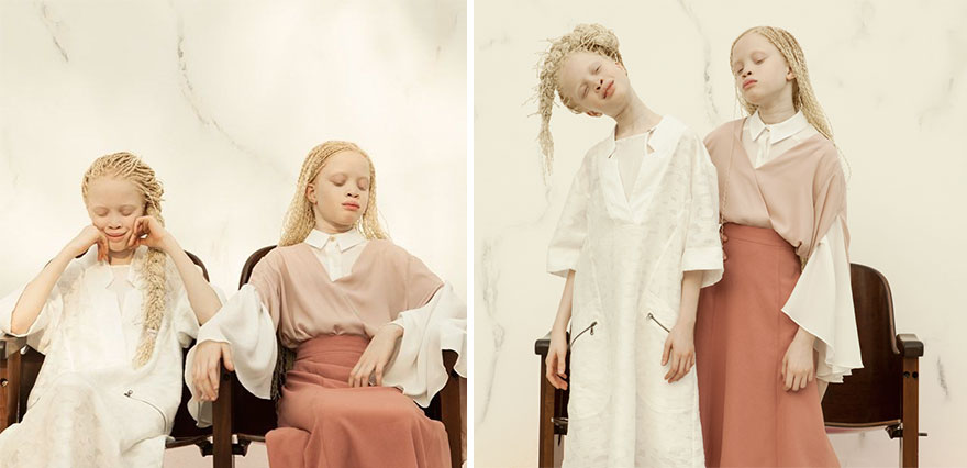 albino-twins-models