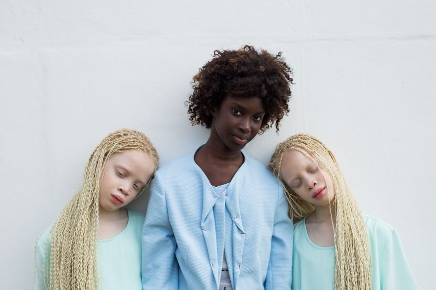 albino-twins-models