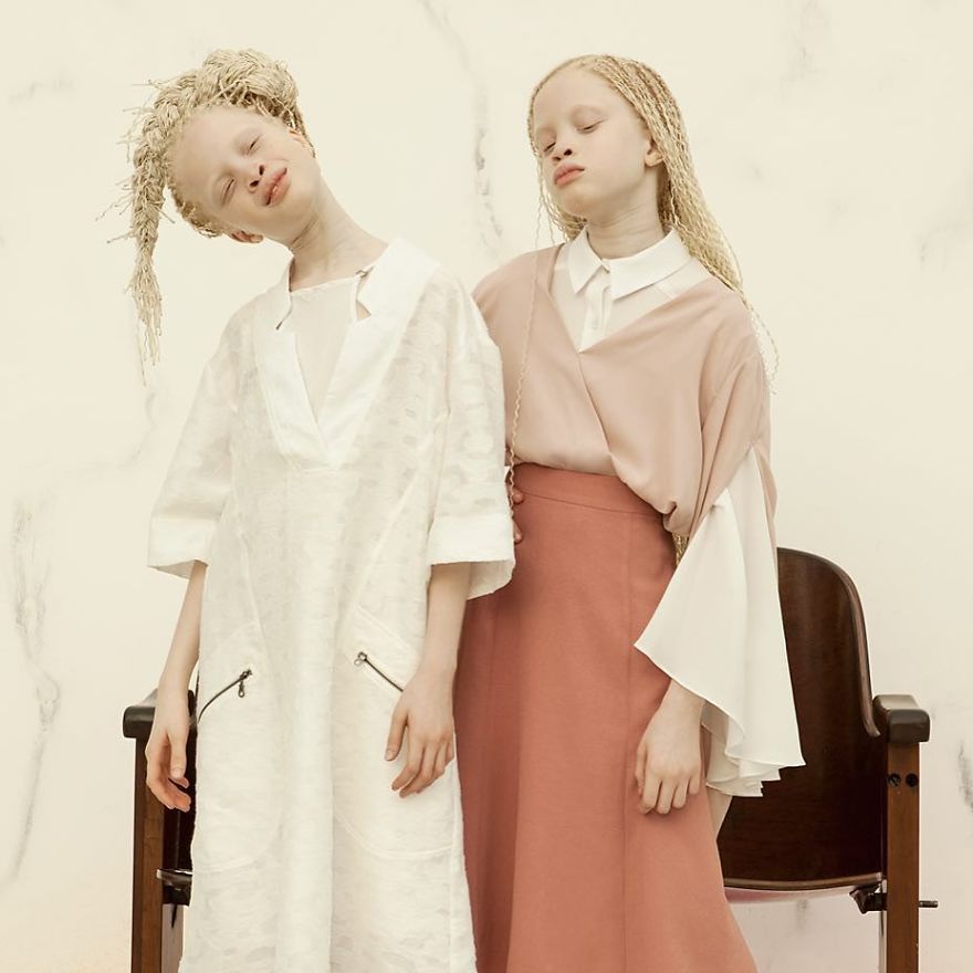 albino-twins-models