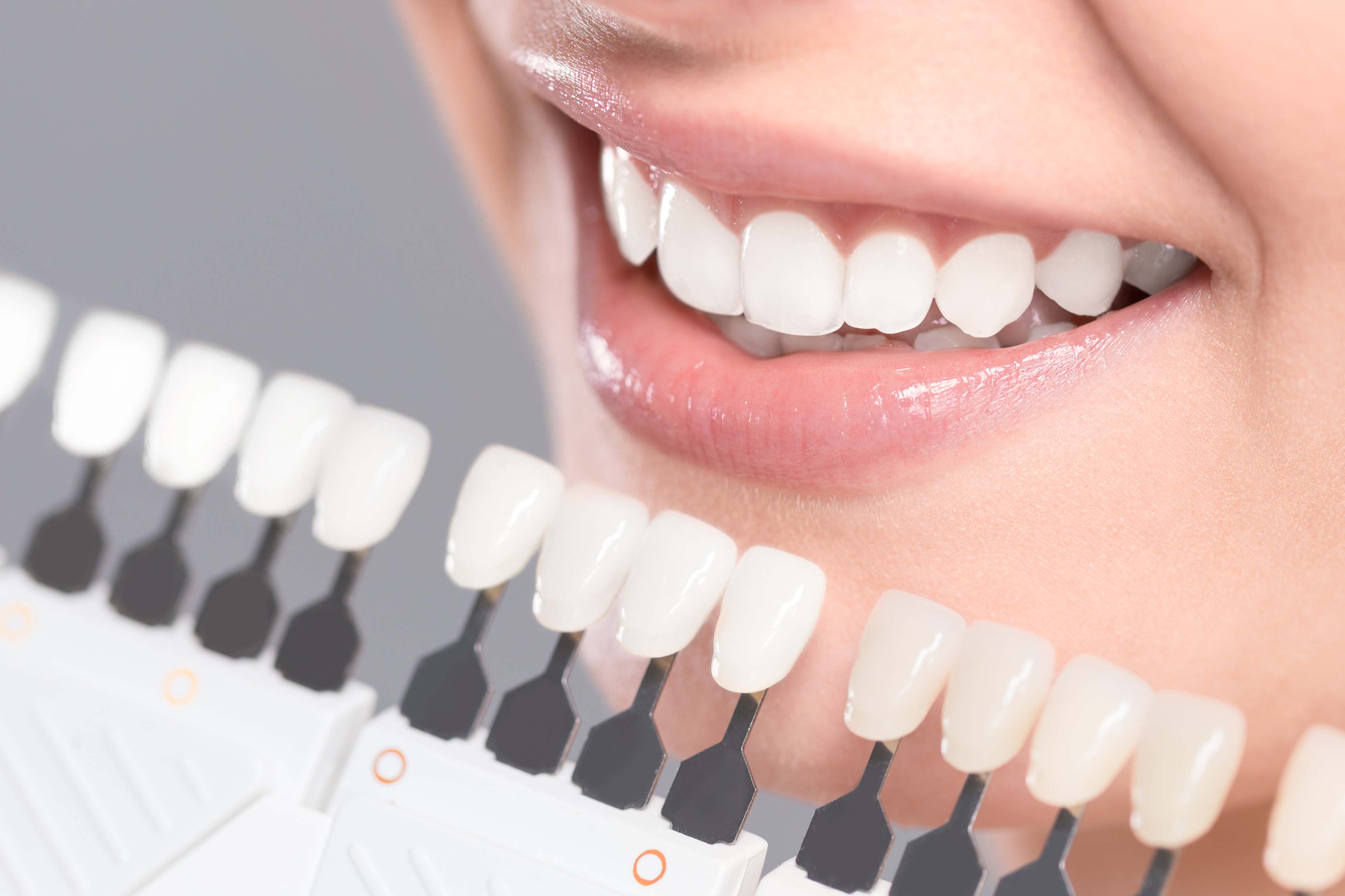 Invisalign treatments