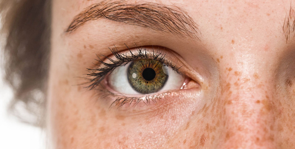 prevent glaucoma