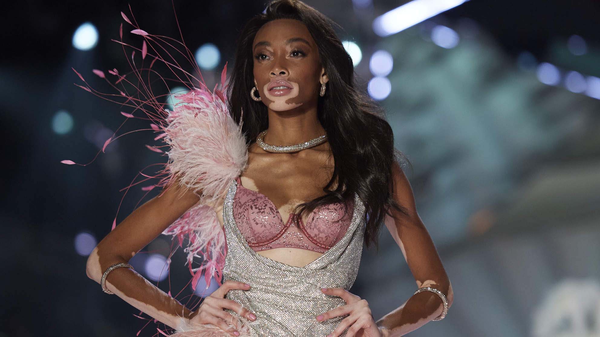 Winnie Harlow walks the runway during the 2018 Victoria's Secret Fashion Show