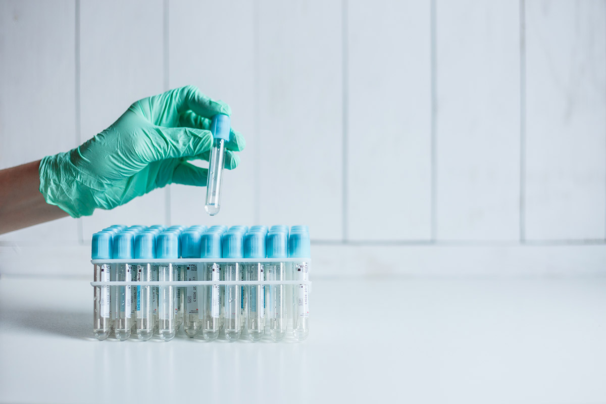 How Best To Pass A Marijuana Drug Test