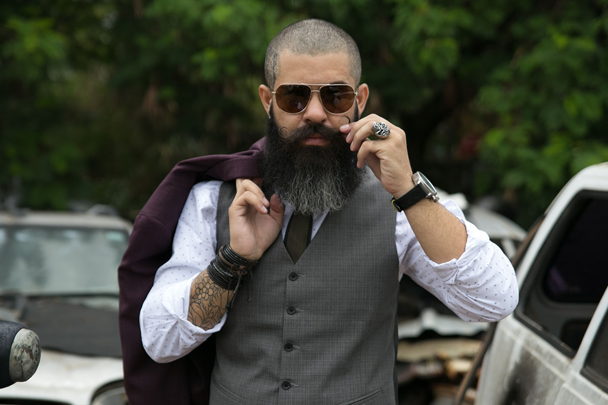 Male Hair Loss