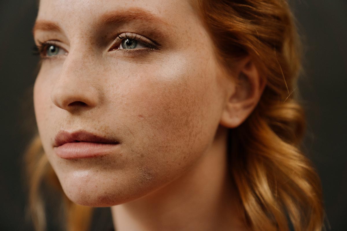 Facial Filler Treatments