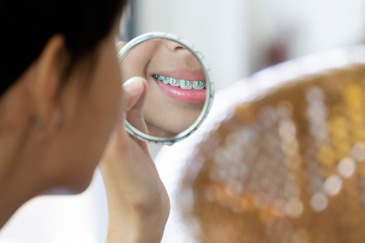 Invisalign for teens