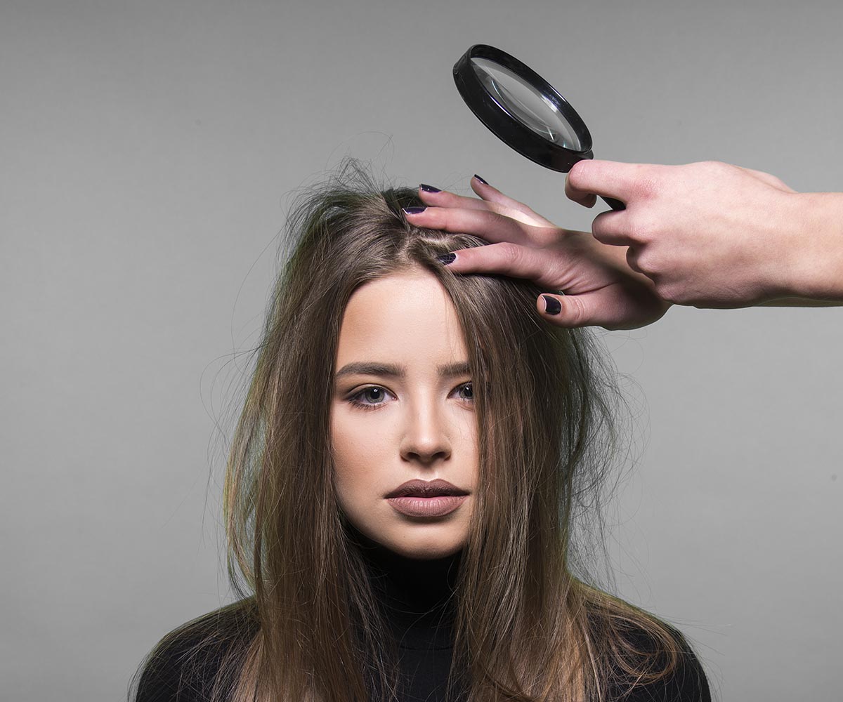 natural remedies for scalp
