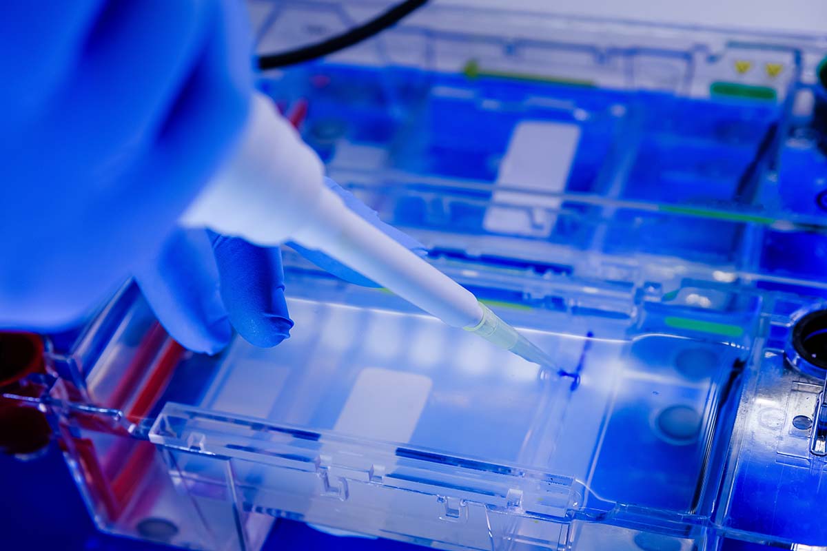 Gel Electrophoresis Explained