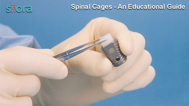 What Are the Advantages of Using Spinal Cages