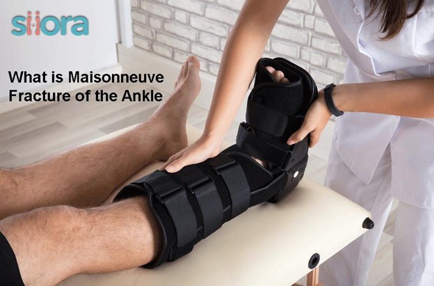 What is Maisonneuve Fracture of the Ankle