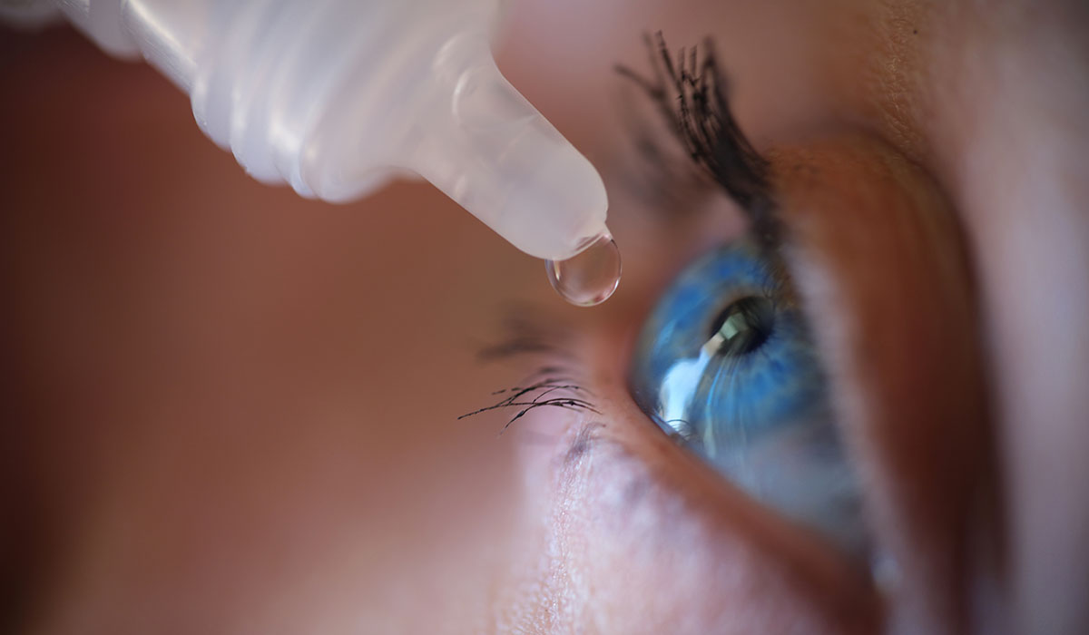 Meibomian Gland Dysfunction