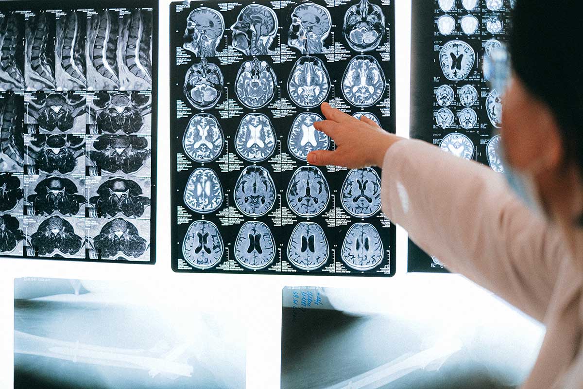 Medical Negligence