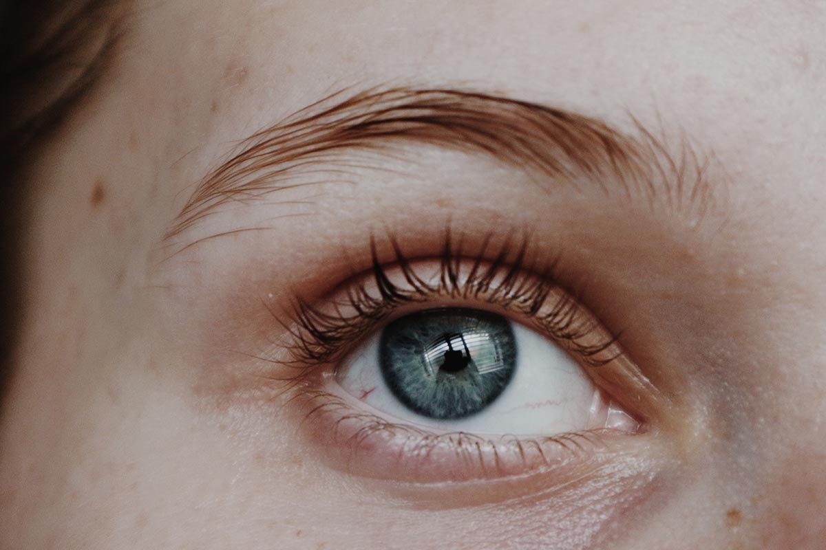 psoriasis on eyelids
