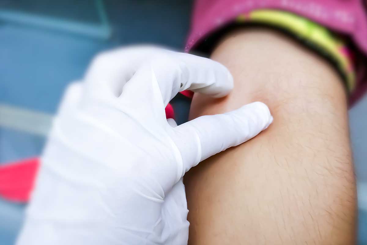 What Does a Phlebotomist Do