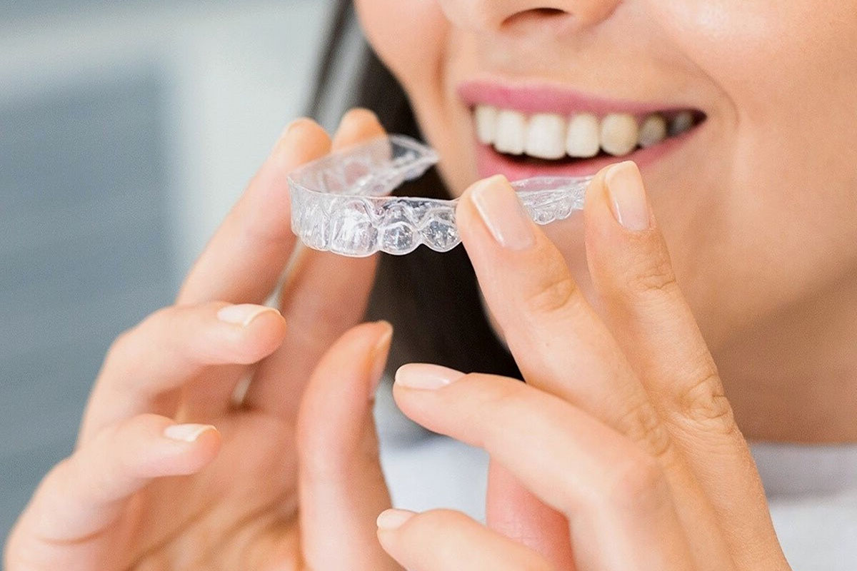 Invisalign Treatment for Adult
