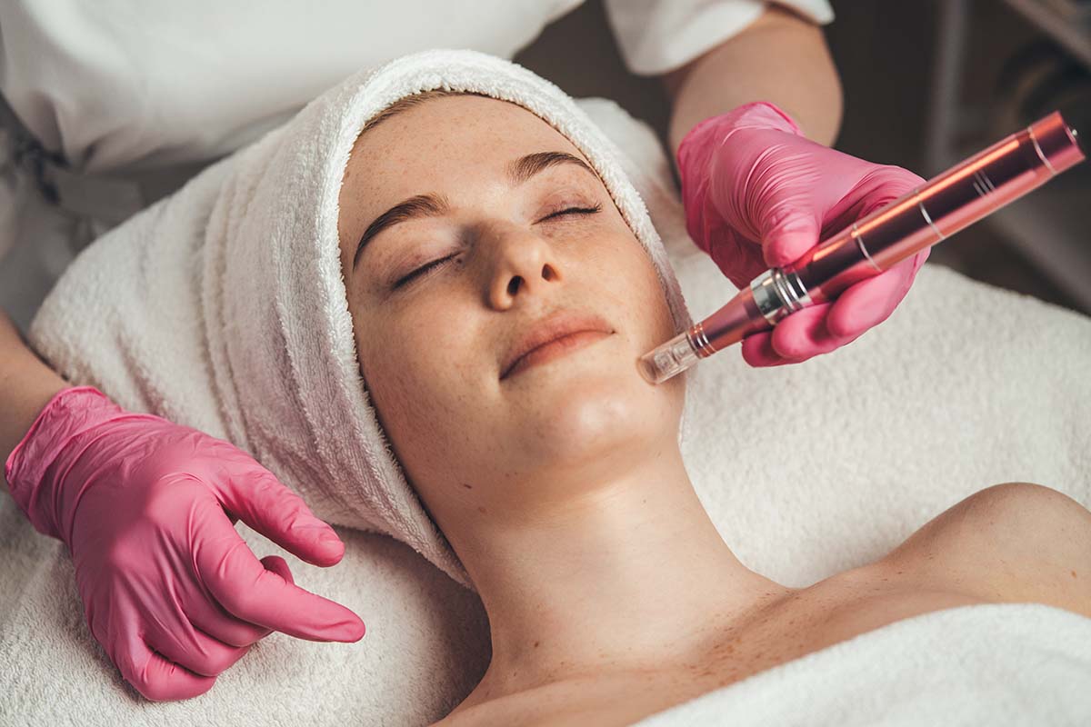 Professional Skin Needling