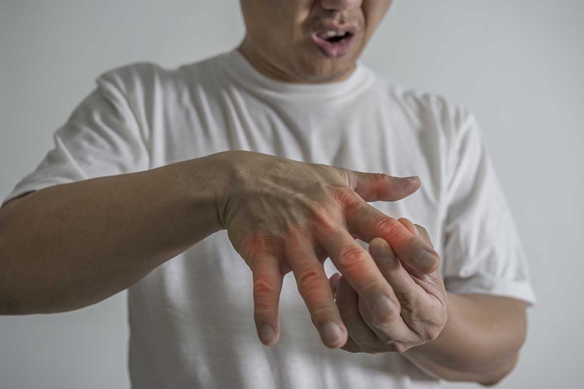 rheumatoid arthritis symptoms