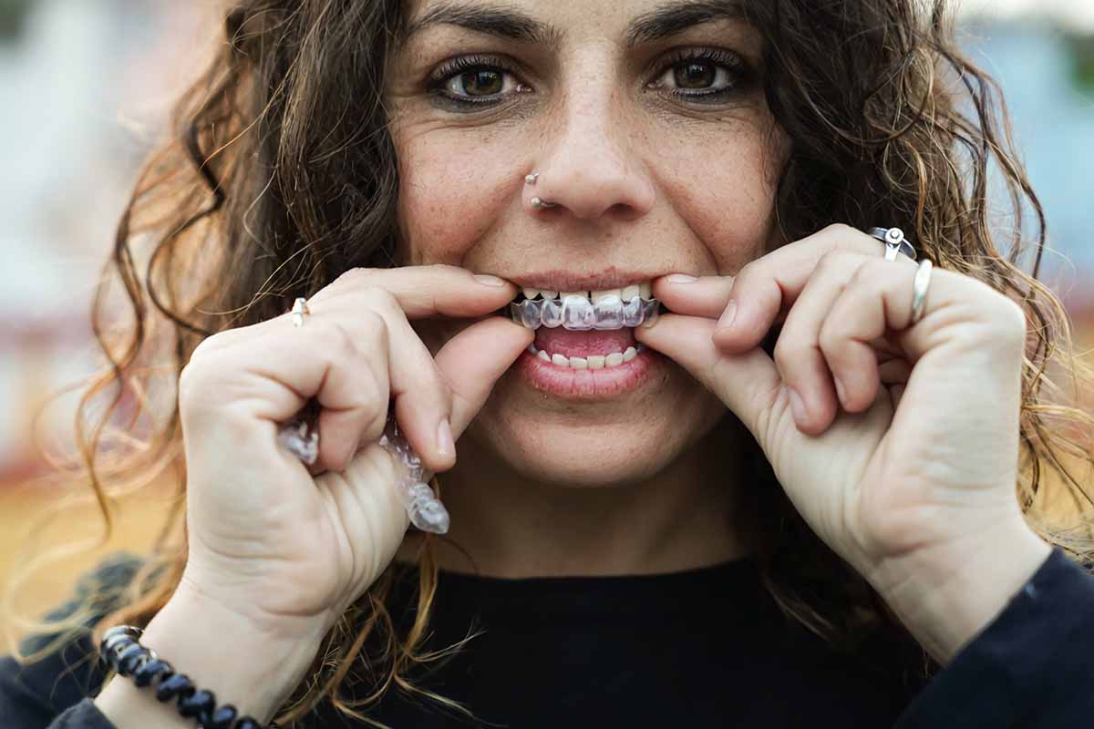 Adult Orthodontics