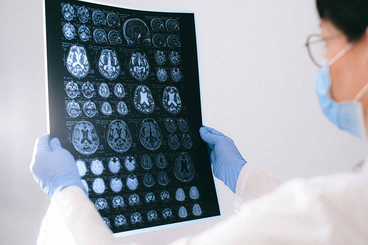 Traumatic Brain Injury Lawyer